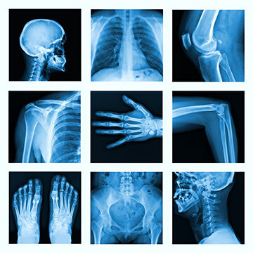 Röntgenbilder von einzelnen Körperpartien 